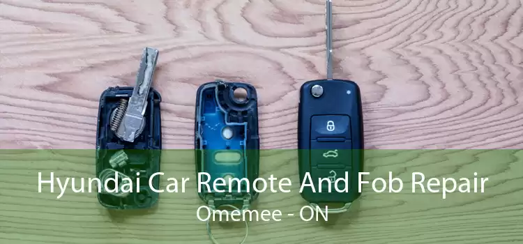 Hyundai Car Remote And Fob Repair Omemee - ON