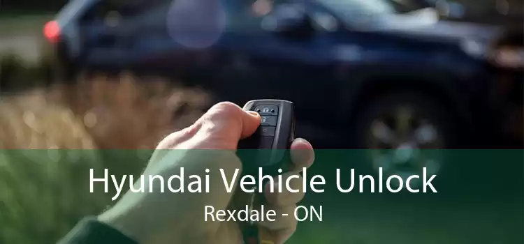 Hyundai Vehicle Unlock Rexdale - ON