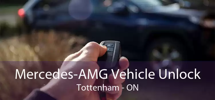 Mercedes-AMG Vehicle Unlock Tottenham - ON