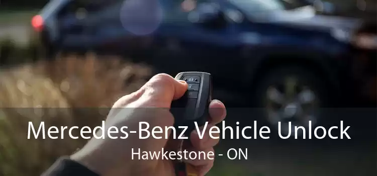 Mercedes-Benz Vehicle Unlock Hawkestone - ON